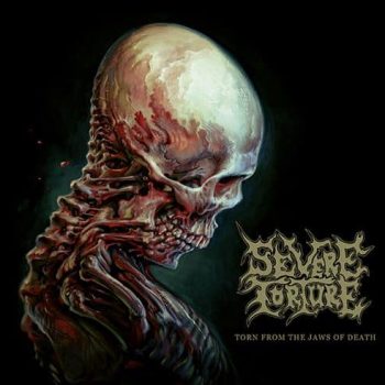 Severe Torture - Torn from the Jaws of Death - Album Cover